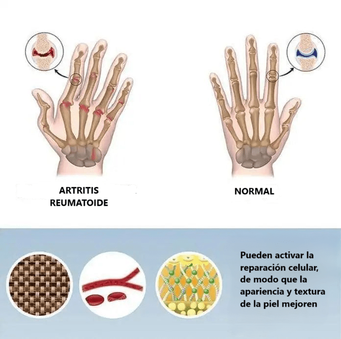 Guantes de Compresión para Artritis - My Store